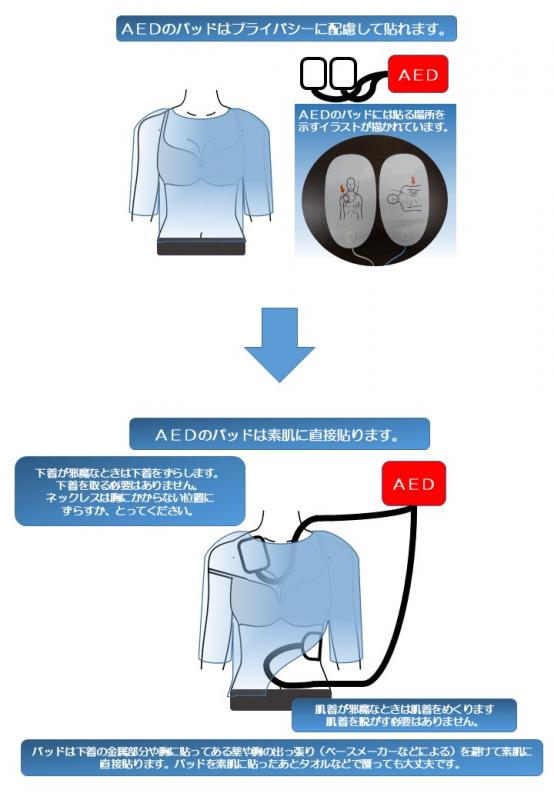 プライバシーへ配慮したAEDの使用方法