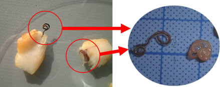 赤魚に付着していた寄生虫の写真